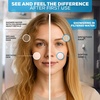 image:imageSparkPod High Output Shower Filter Cartridge Suitable for People with Sensitive and Dry Skin and Scalp Filters Chlorine and Impurities  1min install Standard 3 pcStandard Formula